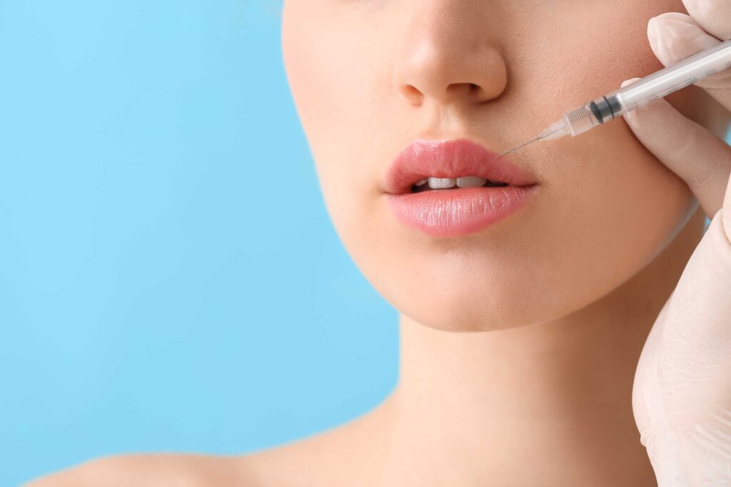 lip fillers