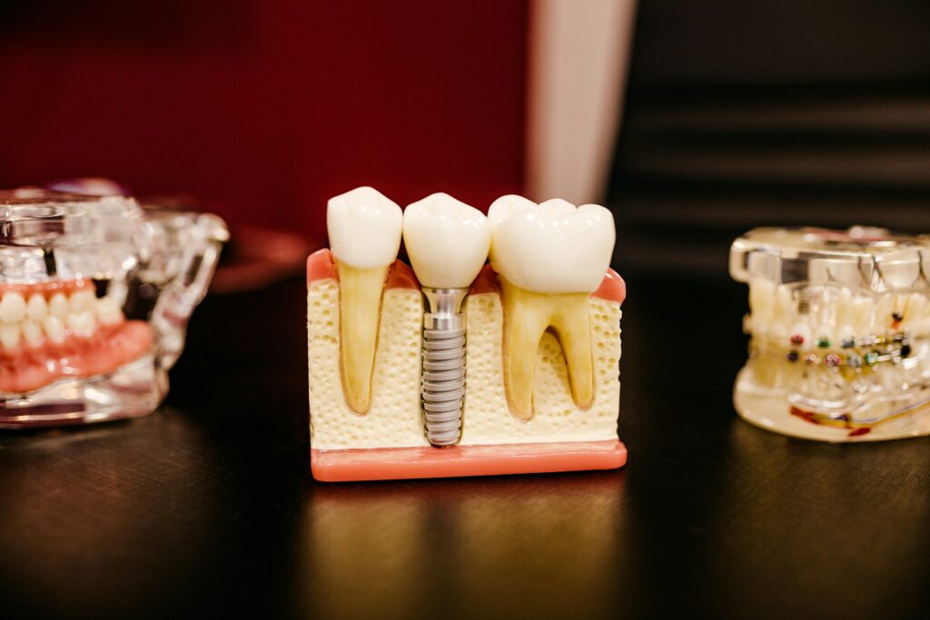 orthodontie cursus orthodontie cursus
