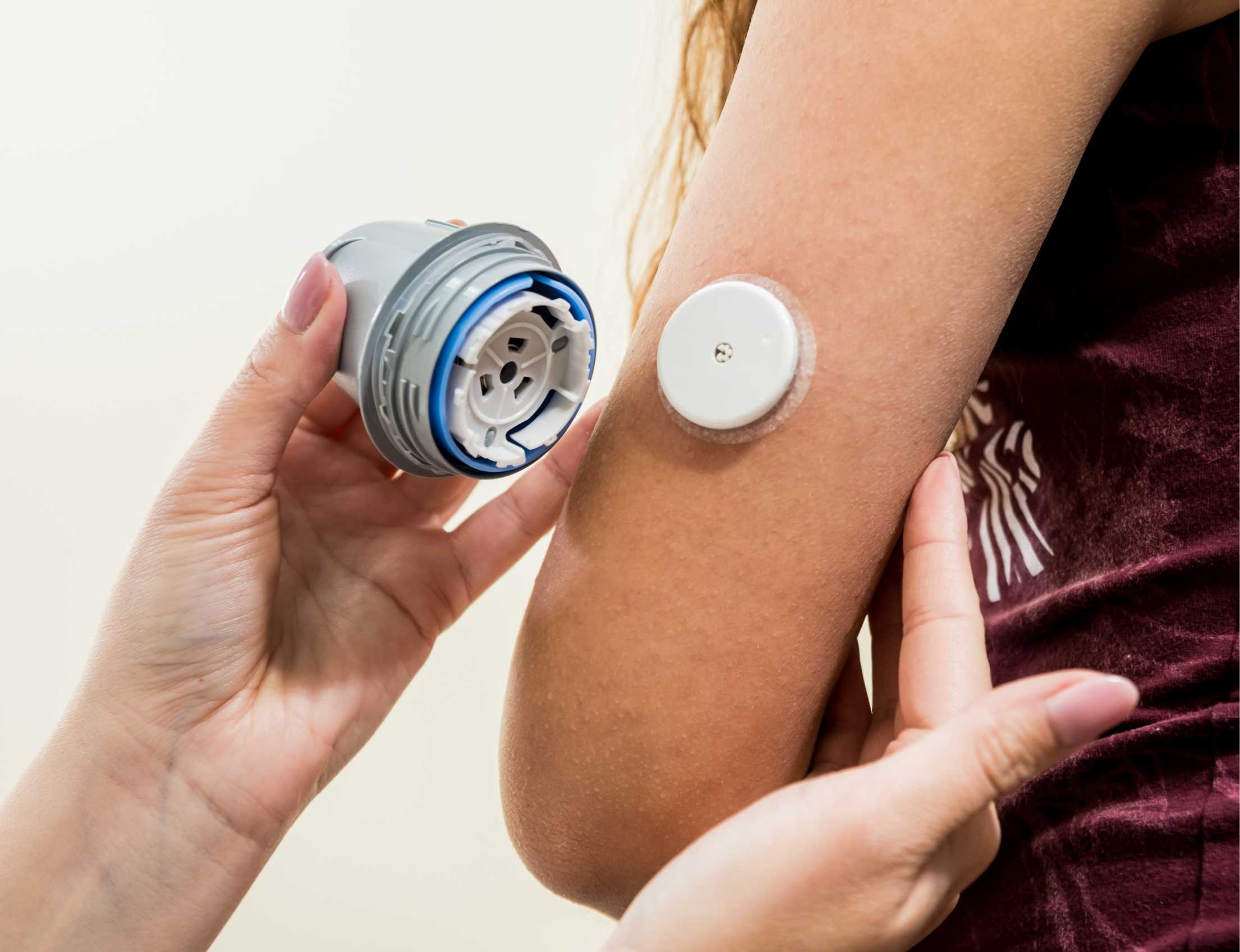 glucose sensor